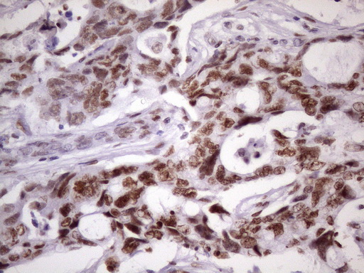 m09247 anti nudt21 mouse monoclonal antibody clone id oti13h1 ihc testing 16