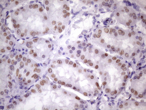 m09247 anti nudt21 mouse monoclonal antibody clone id oti13h1 ihc testing 17