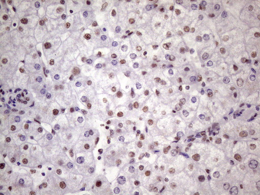 m09247 anti nudt21 mouse monoclonal antibody clone id oti13h1 ihc testing 18
