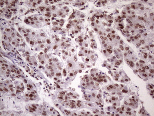 m09247 anti nudt21 mouse monoclonal antibody clone id oti13h1 ihc testing 19
