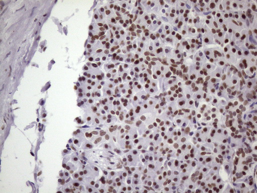 m09247 anti nudt21 mouse monoclonal antibody clone id oti13h1 ihc testing 4