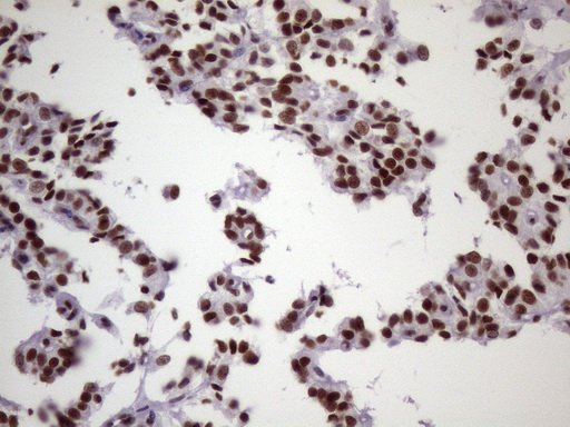 m09247 anti nudt21 mouse monoclonal antibody clone id oti13h1 ihc testing 5