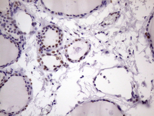 m09247 anti nudt21 mouse monoclonal antibody clone id oti13h1 ihc testing 6