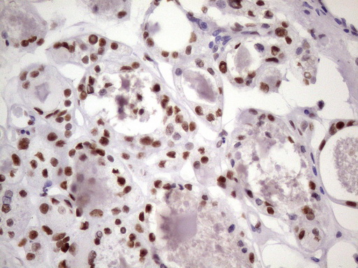 m09247 anti nudt21 mouse monoclonal antibody clone id oti13h1 ihc testing 7