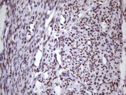 m09247 anti nudt21 mouse monoclonal antibody clone id oti13h1 ihc testing 8