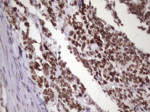 m09247 anti nudt21 mouse monoclonal antibody clone id oti13h1 ihc testing 9