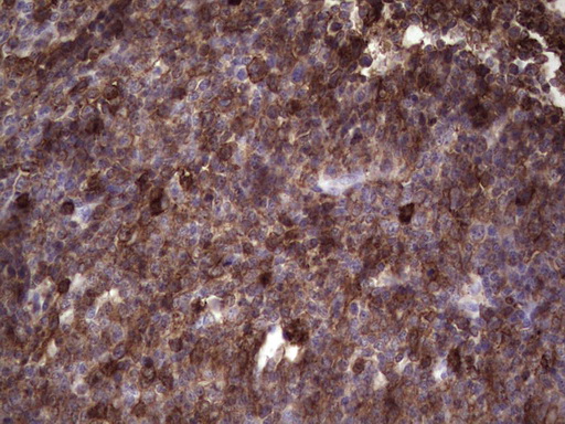 Immunohistochemical staining of paraffin-embedded Human tonsil within the normal limits using anti-ANGPTL1 mouse monoclonal antibody