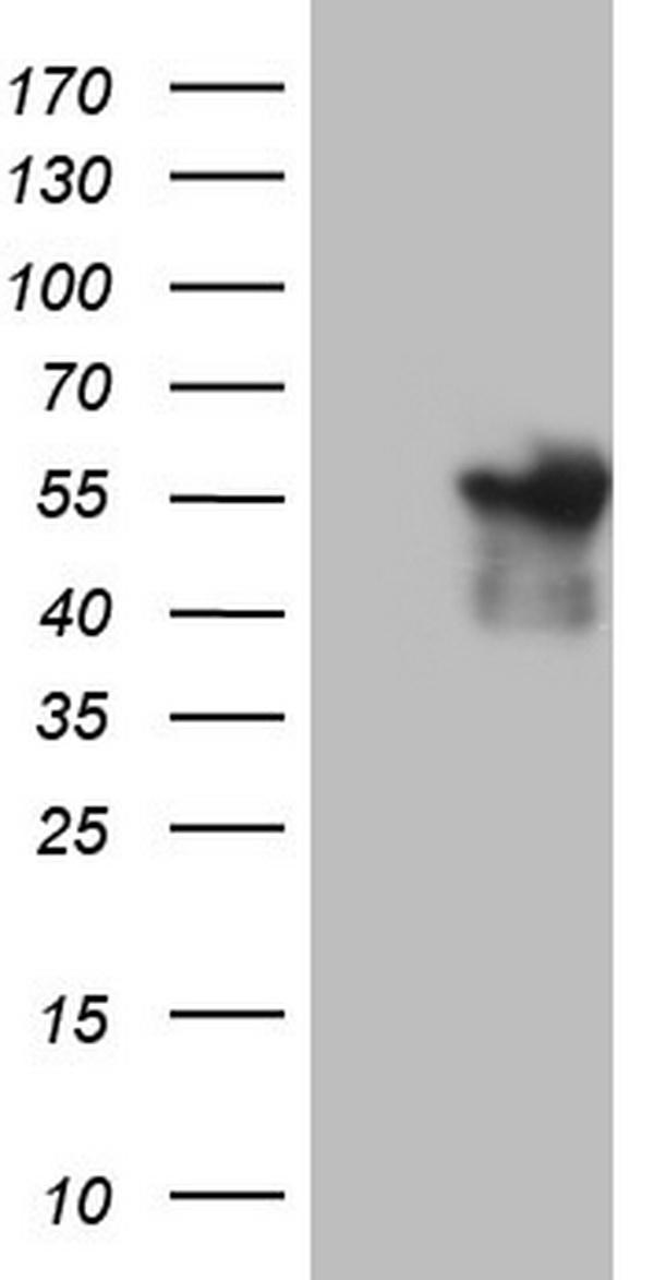 HEK293T cells were transfected with the pCMV6-ENTRY control (Left lane) or pCMV6-ENTRY ANGPTL1 (Right lane) cDNA for 48 hrs and lysed