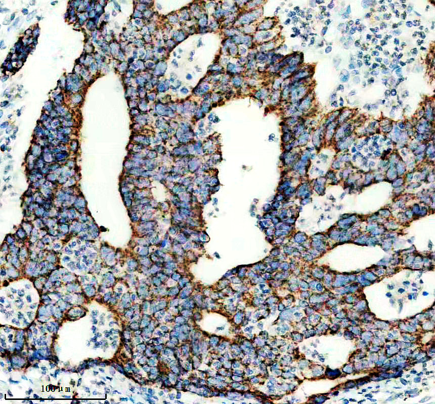 m09277 bdh1 primary antibodies ihc testing 1
