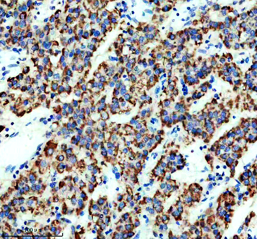 m09277 bdh1 primary antibodies ihc testing 2