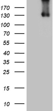 HEK293T cells were transfected with the pCMV6-ENTRY control (Left lane) or pCMV6-ENTRY ITGAD (Right lane) cDNA for 48 hrs and lysed
