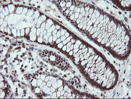 m09303 anti ube2e3 mouse monoclonal antibody clone id oti7e8 ihc testing 11