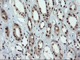 m09303 anti ube2e3 mouse monoclonal antibody clone id oti7e8 ihc testing 12
