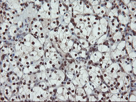 m09303 anti ube2e3 mouse monoclonal antibody clone id oti7e8 ihc testing 13