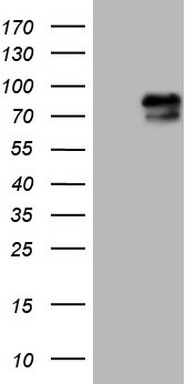 HEK293T cells were transfected with the pCMV6-ENTRY control (Left lane) or pCMV6-ENTRY RAB11FIP4 (Right lane) cDNA for 48 hrs and lysed