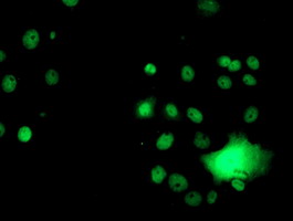 m09339 anti glutathione s transferase theta 2 gstt2 mouse monoclonal antibody clone id oti3b6 if testing 14