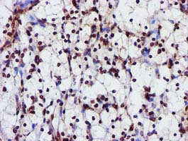 m09339 anti glutathione s transferase theta 2 gstt2 mouse monoclonal antibody clone id oti3b6 ihc testing 10