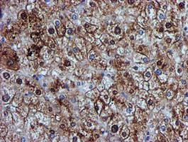 m09339 anti glutathione s transferase theta 2 gstt2 mouse monoclonal antibody clone id oti3b6 ihc testing 11