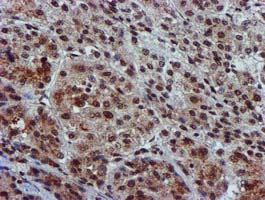 m09339 anti glutathione s transferase theta 2 gstt2 mouse monoclonal antibody clone id oti3b6 ihc testing 12