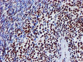 Immunohistochemical staining of paraffin-embedded Human Ovary tissue within the normal limits using anti-GSTT2 mouse monoclonal antibody