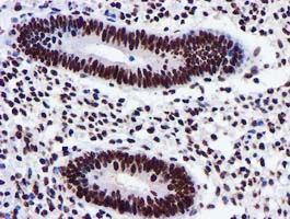 m09339 anti glutathione s transferase theta 2 gstt2 mouse monoclonal antibody clone id oti3b6 ihc testing 4