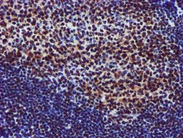m09339 anti glutathione s transferase theta 2 gstt2 mouse monoclonal antibody clone id oti3b6 ihc testing 5