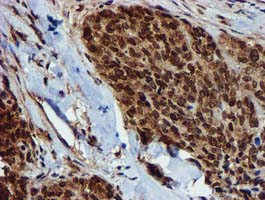 m09339 anti glutathione s transferase theta 2 gstt2 mouse monoclonal antibody clone id oti3b6 ihc testing 6