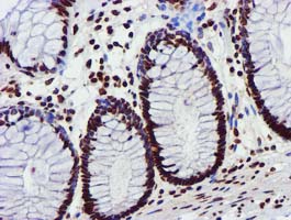 m09339 anti glutathione s transferase theta 2 gstt2 mouse monoclonal antibody clone id oti3b6 ihc testing 7