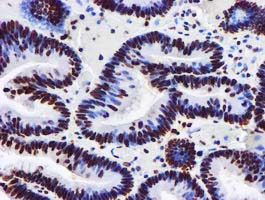 m09339 anti glutathione s transferase theta 2 gstt2 mouse monoclonal antibody clone id oti3b6 ihc testing 8