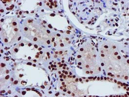 m09339 anti glutathione s transferase theta 2 gstt2 mouse monoclonal antibody clone id oti3b6 ihc testing 9