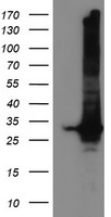 HEK293T cells were transfected with the pCMV6-ENTRY control (Left lane) or pCMV6-ENTRY GSTT2 (Right lane) cDNA for 48 hrs and lysed
