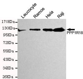 m09343 ppp1r18 primary antiboties wb testing 1