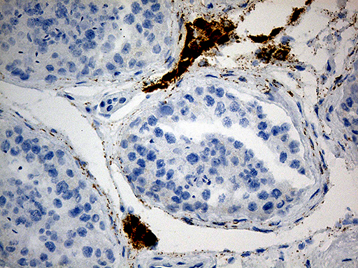 m09345 anti ovary specific acidic protein mgarp mouse monoclonal antibody clone id oti3d9 ihc testing 2