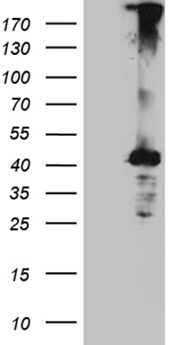 m09345 anti ovary specific acidic protein mgarp mouse monoclonal antibody clone id oti3d9 wb testing 1