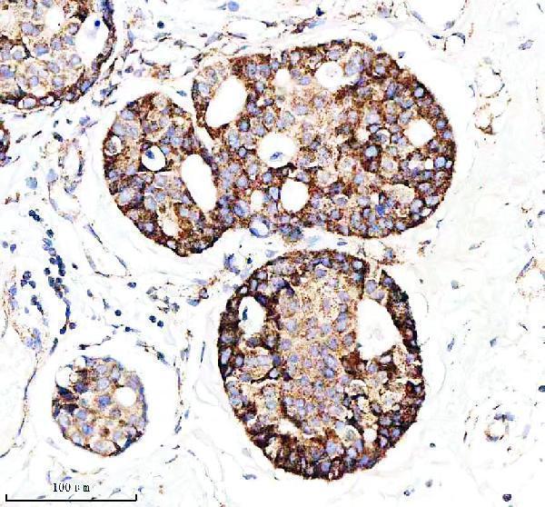  IHC analysis of BCL2L14 using anti-BCL2L14 antibody (M09347-1)