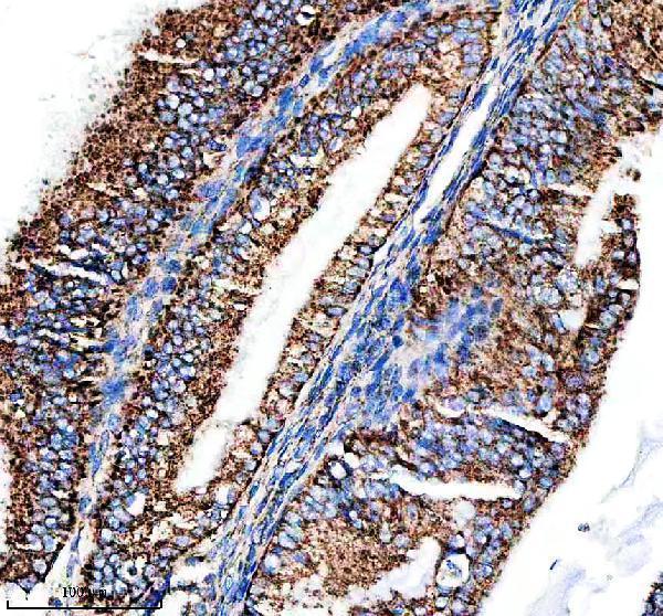  IHC analysis of BCL2L14 using anti-BCL2L14 antibody (M09347-1)
