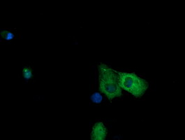 m09352 anti ndor1 mouse monoclonal antibody clone id oti1e3 if testing 10