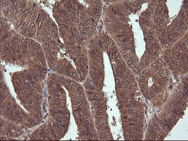 m09352 anti ndor1 mouse monoclonal antibody clone id oti1e3 ihc testing 4