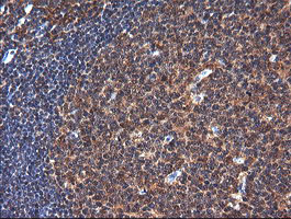 m09352 anti ndor1 mouse monoclonal antibody clone id oti1e3 ihc testing 5