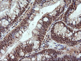 m09352 anti ndor1 mouse monoclonal antibody clone id oti1e3 ihc testing 6