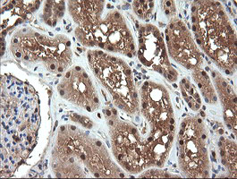 m09352 anti ndor1 mouse monoclonal antibody clone id oti1e3 ihc testing 7