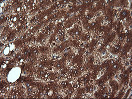m09352 anti ndor1 mouse monoclonal antibody clone id oti1e3 ihc testing 8