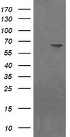 HEK293T cells were transfected with the pCMV6-ENTRY control (Left lane) or pCMV6-ENTRY NDOR1 (Right lane) cDNA for 48 hrs and lysed
