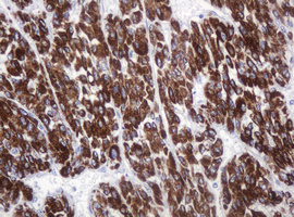m09355 anti amy2b mouse monoclonal antibody clone id oti4b5 ihc testing 4
