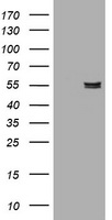 HEK293T cells were transfected with the pCMV6-ENTRY control (Left lane) or pCMV6-ENTRY AMY2B (Right lane) cDNA for 48 hrs and lysed