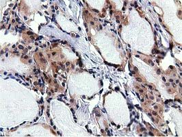 m09378 anti rbbp9 mouse monoclonal antibody clone id oti4g3 ihc testing 2