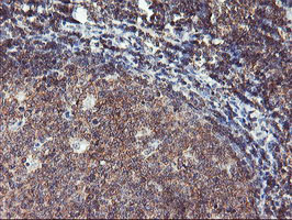 m09384 2 anti tulp3 mouse monoclonal antibody clone id oti7b8 ihc testing 6