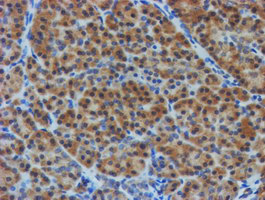 m09384 anti tulp3 mouse monoclonal antibody clone id oti4e5 ihc testing 5