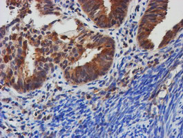m09384 anti tulp3 mouse monoclonal antibody clone id oti4e5 ihc testing 7