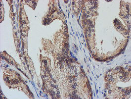 m09384 anti tulp3 mouse monoclonal antibody clone id oti4e5 ihc testing 8